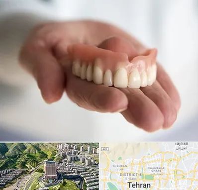 لیفت لثه با لیزر در شمال تهران 