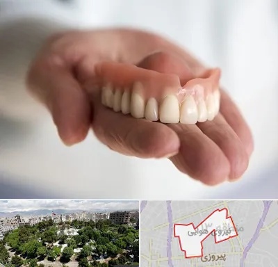 لیفت لثه با لیزر در نیروی هوایی