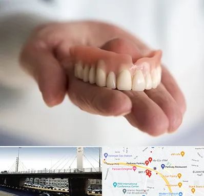 لیفت لثه با لیزر در پارک وی 