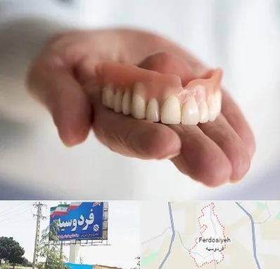 لیفت لثه با لیزر در فردوسیه شهریار