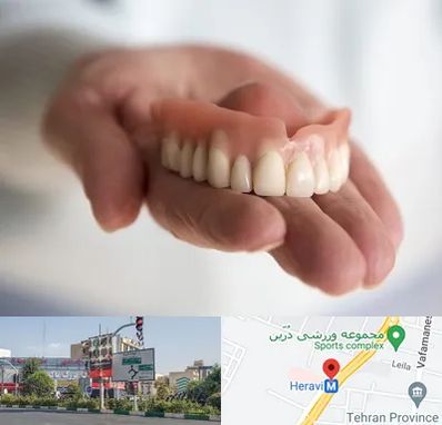 لیفت لثه با لیزر در هروی 