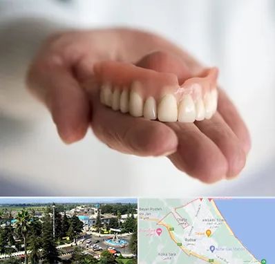 لیفت لثه با لیزر در رودسر