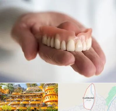 لیفت لثه با لیزر در دربند