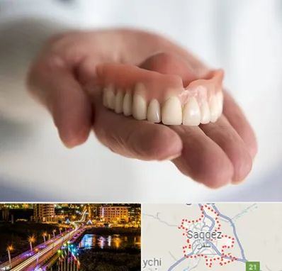 لیفت لثه با لیزر در سقز