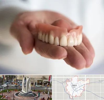 لیفت لثه با لیزر در زابل