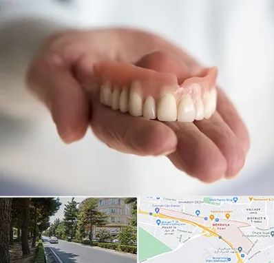 لیفت لثه با لیزر در مهرویلا کرج