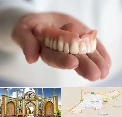 لیفت لثه با لیزر در سمنان