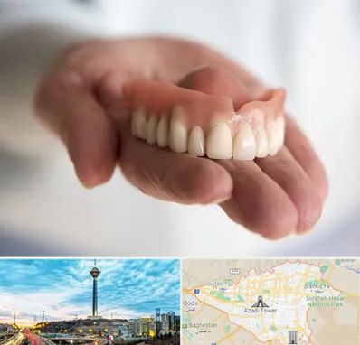 لیفت لثه با لیزر در تهران