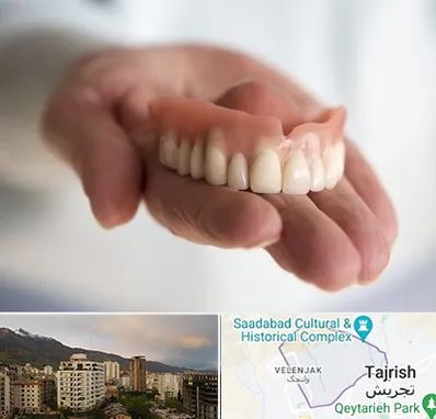 لیفت لثه با لیزر در زعفرانیه 