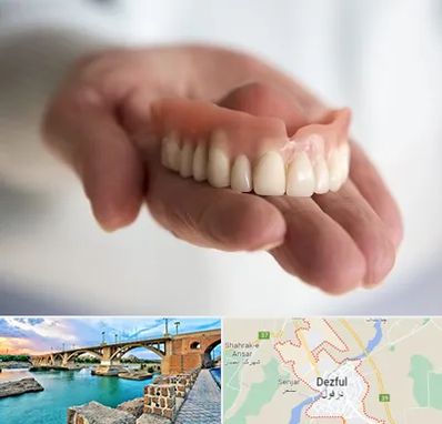 لیفت لثه با لیزر در دزفول