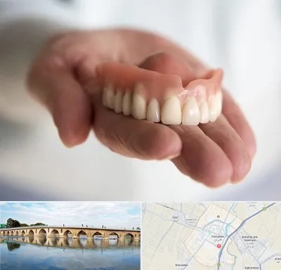 لیفت لثه با لیزر در فلاورجان