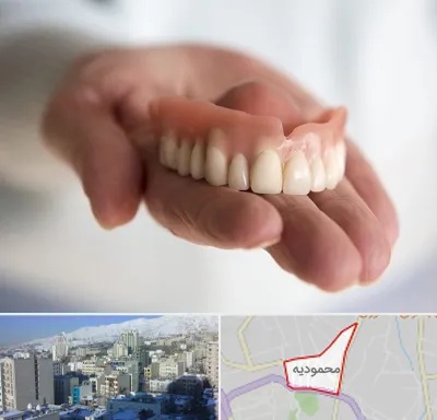 لیفت لثه با لیزر در محمودیه