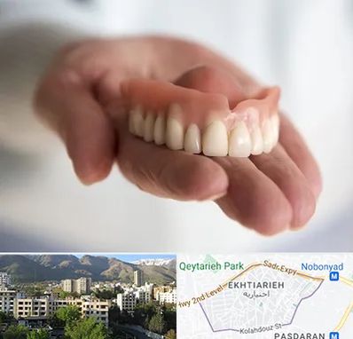 لیفت لثه با لیزر در اختیاریه 