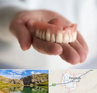 لیفت لثه با لیزر در فیروزکوه