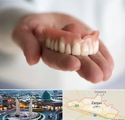 لیفت لثه با لیزر در زنجان