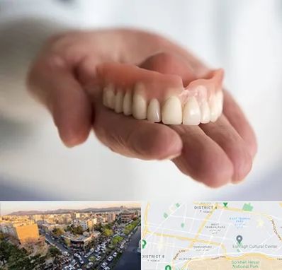 لیفت لثه با لیزر در تهرانپارس 