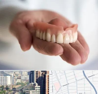 لیفت لثه با لیزر در خیابان بهشتی