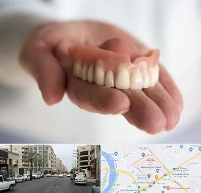 لیفت لثه با لیزر در زیتون کارمندی اهواز