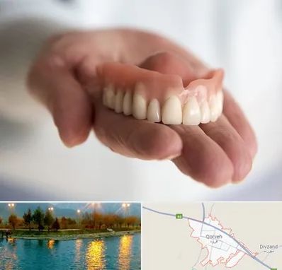 لیفت لثه با لیزر در قروه