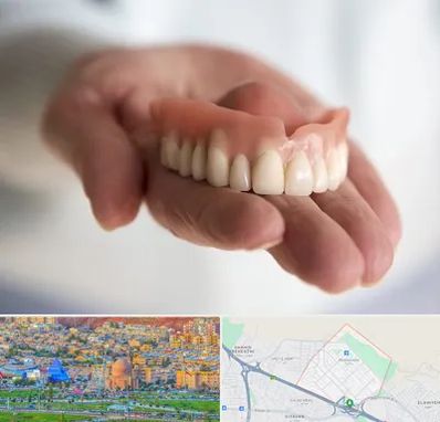 لیفت لثه با لیزر در رشدیه تبریز