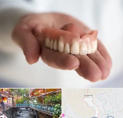 لیفت لثه با لیزر در درکه