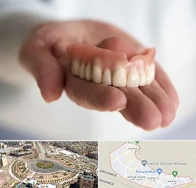 لیفت لثه با لیزر در پرند