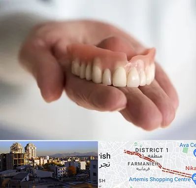 لیفت لثه با لیزر در فرمانیه 