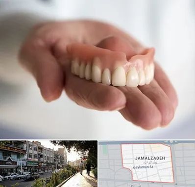 لیفت لثه با لیزر در خیابان جمالزاده