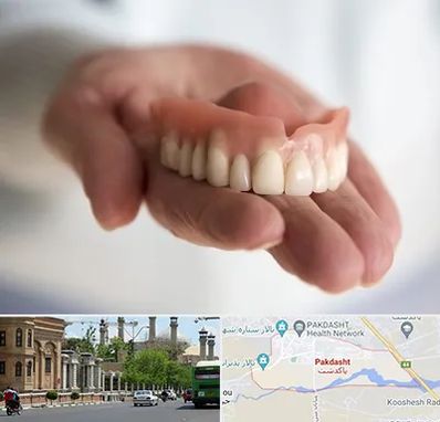 لیفت لثه با لیزر در پاکدشت