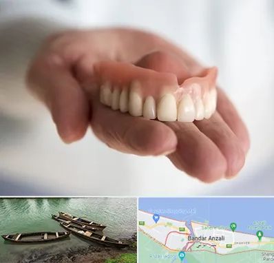 لیفت لثه با لیزر در بندر انزلی