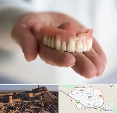 لیفت لثه با لیزر در بم