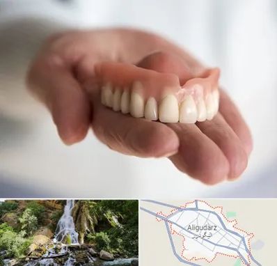 لیفت لثه با لیزر در الیگودرز