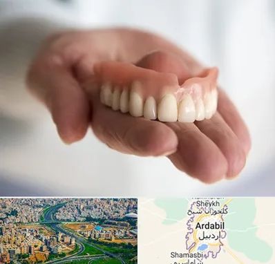 لیفت لثه با لیزر در اردبیل