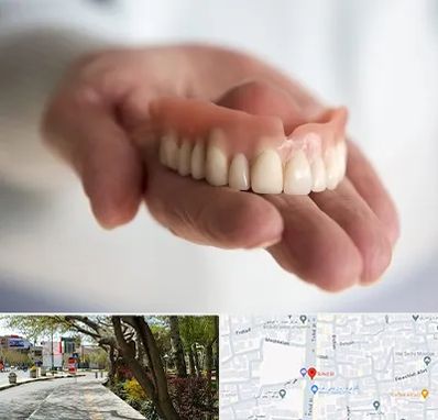 لیفت لثه با لیزر در خیابان توحید اصفهان