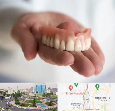 لیفت لثه با لیزر در ونک 