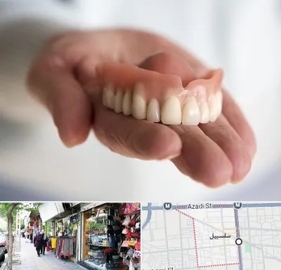 لیفت لثه با لیزر در سلسبیل