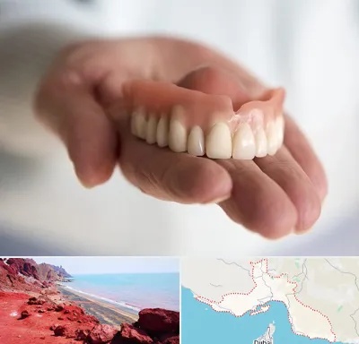 لیفت لثه با لیزر در هرمزگان