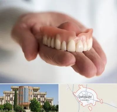 لیفت لثه با لیزر در دهدشت