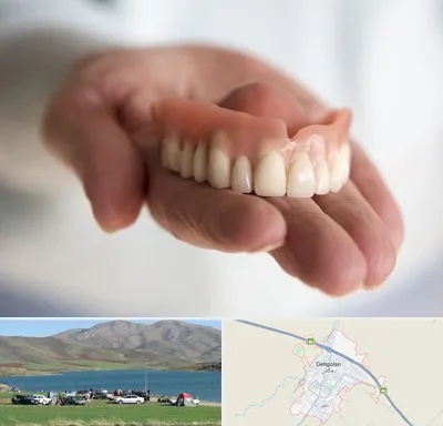 لیفت لثه با لیزر در دهگلان