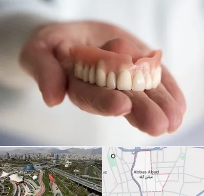 لیفت لثه با لیزر در عباس آباد تهران