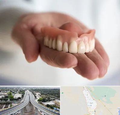 لیفت لثه با لیزر در اندیمشک