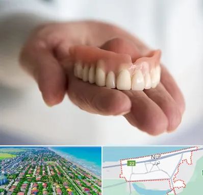 لیفت لثه با لیزر در نور
