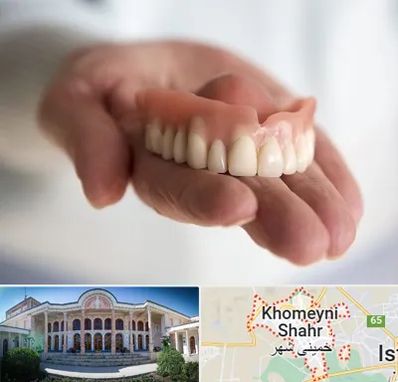 لیفت لثه با لیزر در خمینی شهر