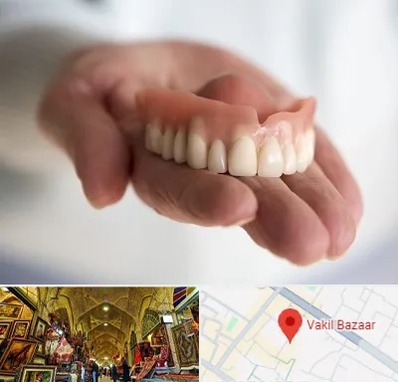 لیفت لثه با لیزر در بازار وکیل شیراز