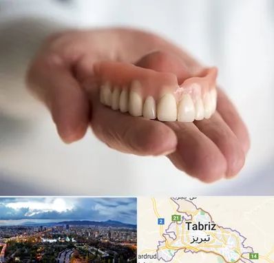 لیفت لثه با لیزر در تبریز