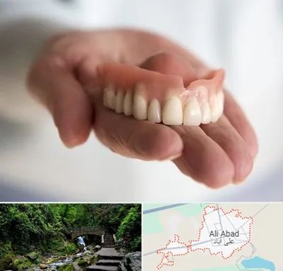 لیفت لثه با لیزر در علی آباد کتول