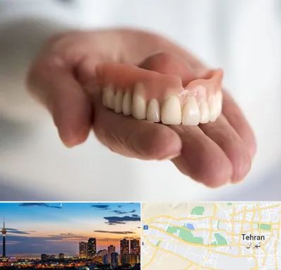 لیفت لثه با لیزر در غرب تهران 