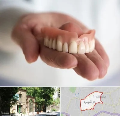 لیفت لثه با لیزر در دزاشیب