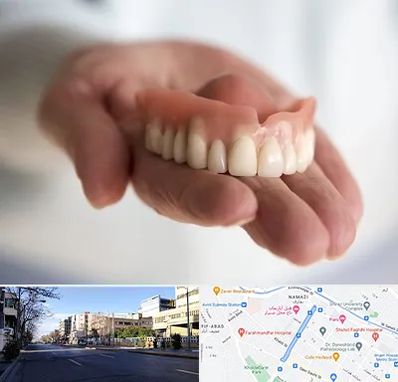 لیفت لثه با لیزر در خیابان ملاصدرا شیراز