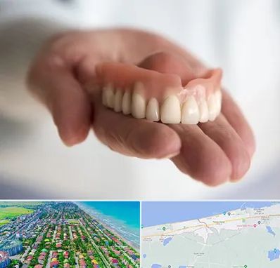 لیفت لثه با لیزر در فریدونکنار